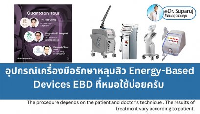 Update เทคนิคดูแลหลุมสิวที่หมอใช้บ่อยครับ (7/2023)